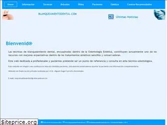 blanqueamientodental.com