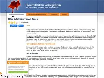 bloedvlekkenverwijderen.nl