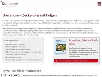 borreliose-infektionskrankheiten.de