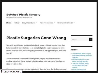 botchedplasticsurgery.org