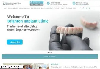 brightonimplantclinic.co.uk