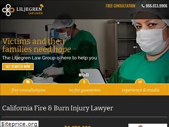 californiaburninjurylawyer.net