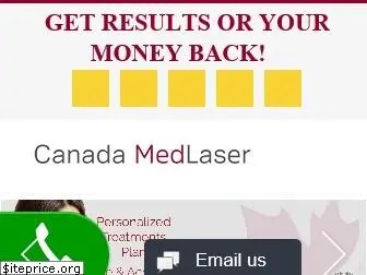 canadamedlaser.ca