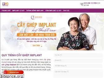 cayghepimplant.com.vn