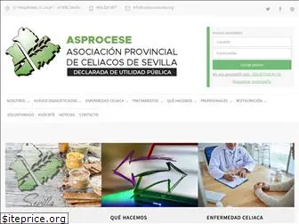 celiacossevilla.org