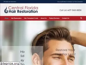 centralfloridahairrestoration.com