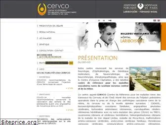 cervco.fr