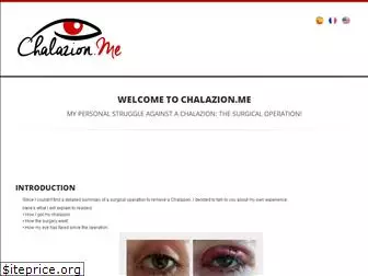 chalazion.me