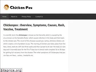 chickenpox.me
