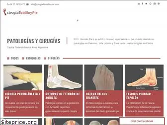 cirugiadetobilloypie.com