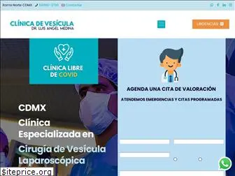 cirugiadevesiculamexico.com.mx