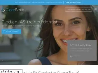 clearsmilealigner.com