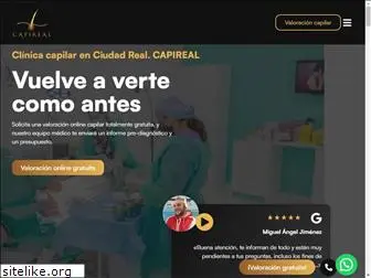 clinicacapilarciudadreal.com