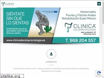 clinicadecoloproctologia.es
