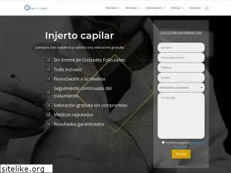 clinicainjertocapilar.net