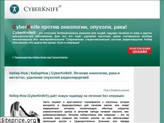 cliniccyberknife.ru