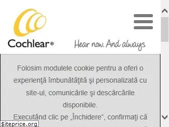 cochlear.ro