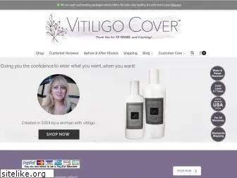 covervitiligo.com