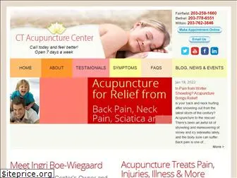ctacupuncture.com