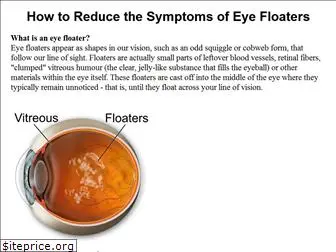 cure-eye-floaters.com