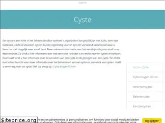 cyste.net