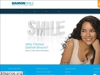 damonsmile.in