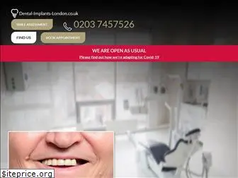 dental-implants-london.co.uk