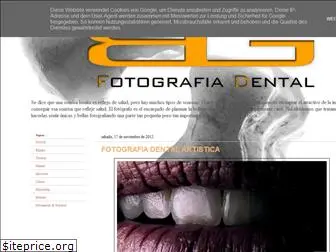 dentalfotografia.blogspot.com