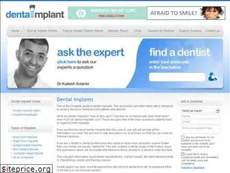 dentalimplant.co.uk