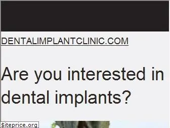 dentalimplantclinic.com