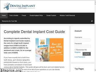 dentalimplantcostguide.com