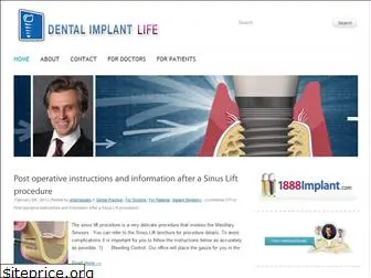 dentalimplantlife.com