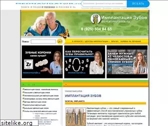 dentalimplants.ru