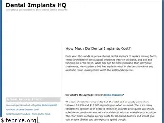 dentalimplantscosthq.com