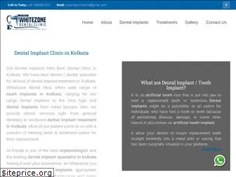 dentalimplantsinkolkata.com