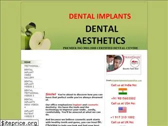 dentalimplantsjalandhar.com