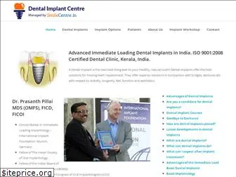 dentalimplantskerala.com