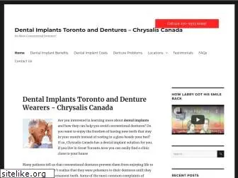 dentalimplantstoronto.info