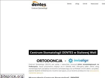 dentes.pl