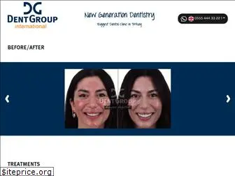 dentgroupinternational.com