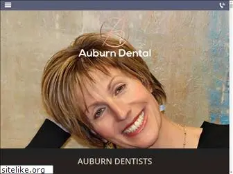 dentistinauburnal.com