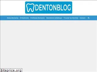 dentonblog.fr