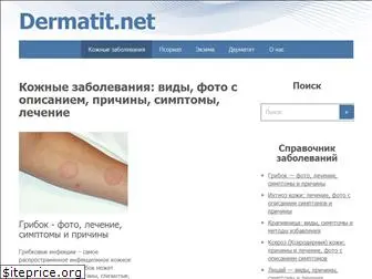 dermatit.net