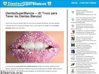 dientessuperblancos.com