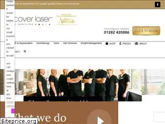 discoverlaser.co.uk