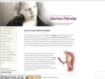 drfibroid.com