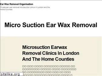 earwaxremoval.net