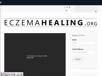 eczemahealing.org