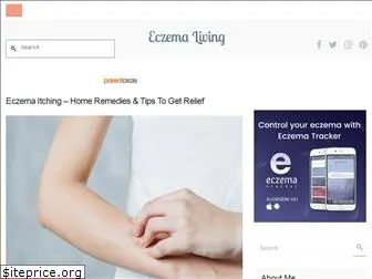 eczemaliving.com