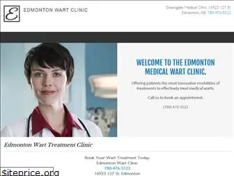 edmontonwartclinic.com